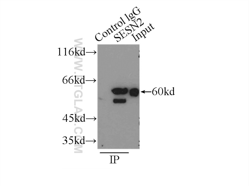 Immunoprecipitation (IP) experiment of K-562 cells using Sestrin 2 Polyclonal antibody (10795-1-AP)
