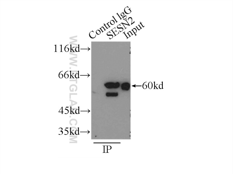 IP experiment of K-562 using 10795-1-AP