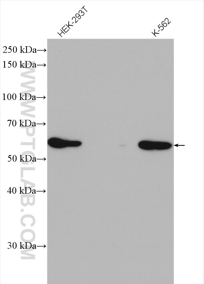 Western Blot (WB) analysis of various lysates using Sestrin 2 Polyclonal antibody (10795-1-AP)