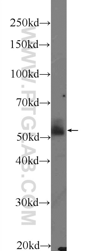 Western Blot (WB) analysis of rat liver tissue using Sestrin 2 Polyclonal antibody (10795-1-AP)