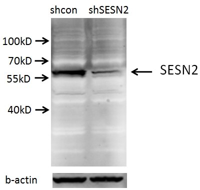 Western Blot (WB) analysis of A549 cells using Sestrin 2 Polyclonal antibody (10795-1-AP)