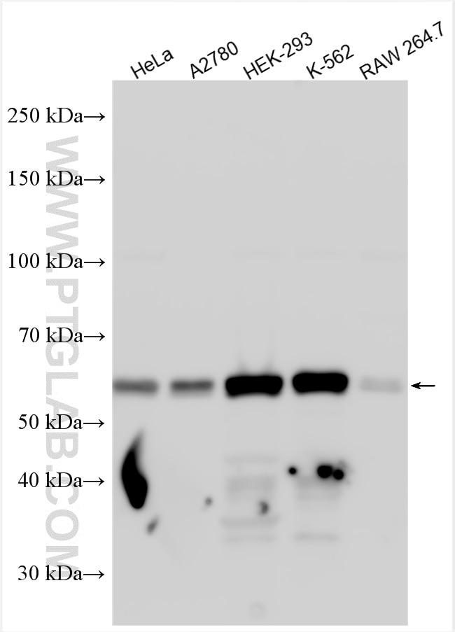 Western Blot (WB) analysis of various lysates using Sestrin 2 Polyclonal antibody (10795-1-AP)