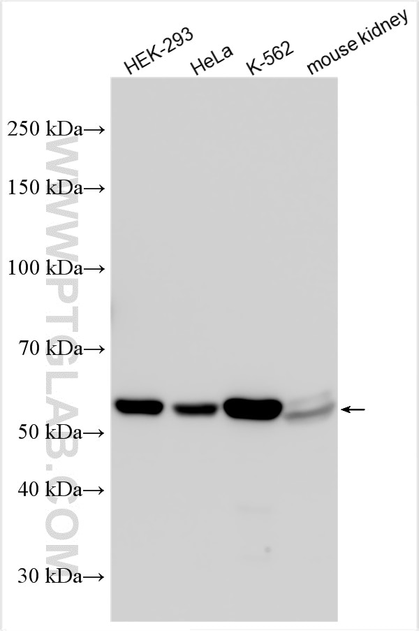 Western Blot (WB) analysis of various lysates using Sestrin 2 Polyclonal antibody (10795-1-AP)