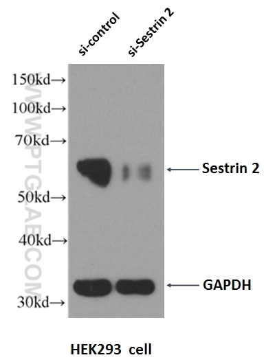 Western Blot (WB) analysis of HEK-293 cells using Sestrin 2 Polyclonal antibody (10795-1-AP)