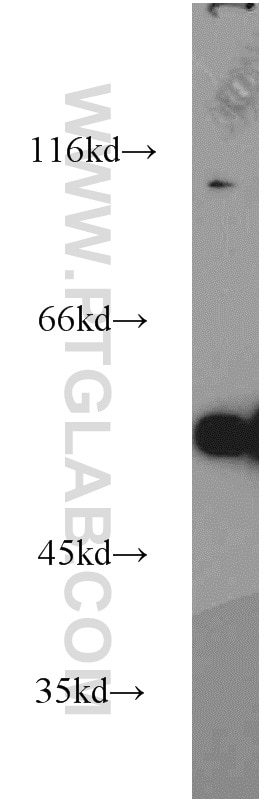 Western Blot (WB) analysis of K-562 cells using Sestrin 2 Polyclonal antibody (10795-1-AP)