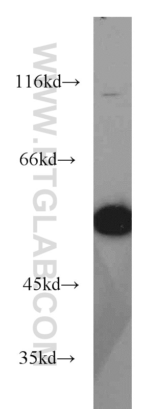 Western Blot (WB) analysis of HEK-293 cells using Sestrin 2 Polyclonal antibody (10795-1-AP)