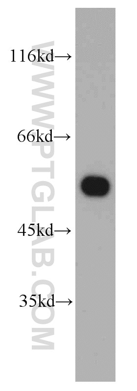 Western Blot (WB) analysis of HeLa cells using Sestrin 2 Polyclonal antibody (10795-1-AP)