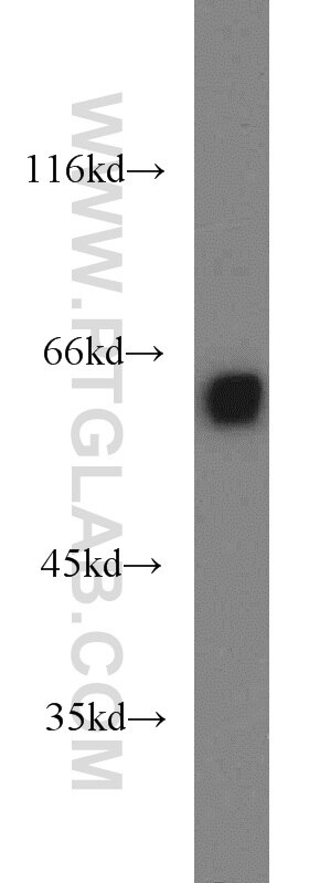Western Blot (WB) analysis of A2780 cells using Sestrin 2 Polyclonal antibody (10795-1-AP)