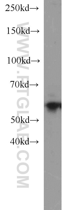 Western Blot (WB) analysis of RAW264.7 using Sestrin 2 Polyclonal antibody (10795-1-AP)