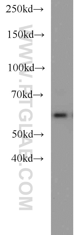 Western Blot (WB) analysis of NIH/3T3 cells using Sestrin 2 Polyclonal antibody (10795-1-AP)