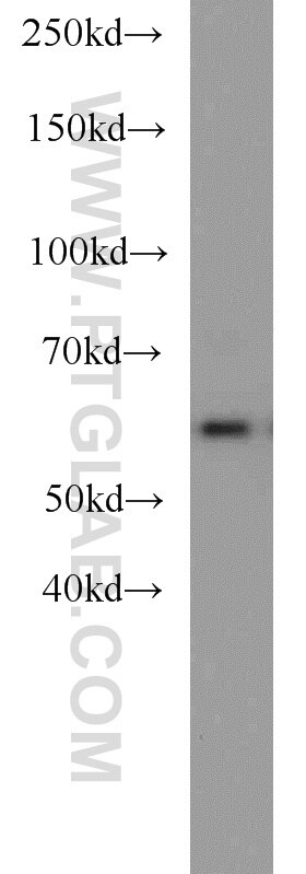 Western Blot (WB) analysis of NIH/3T3 cells using Sestrin 2 Polyclonal antibody (10795-1-AP)