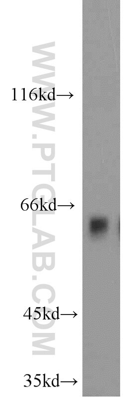 Western Blot (WB) analysis of HEK-293 cells using Sestrin 2 Polyclonal antibody (10795-1-AP)