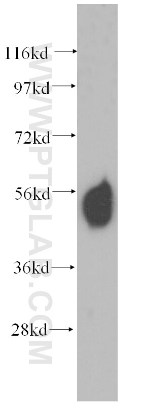 Western Blot (WB) analysis of human liver tissue using Sestrin 2 Polyclonal antibody (10795-1-AP)