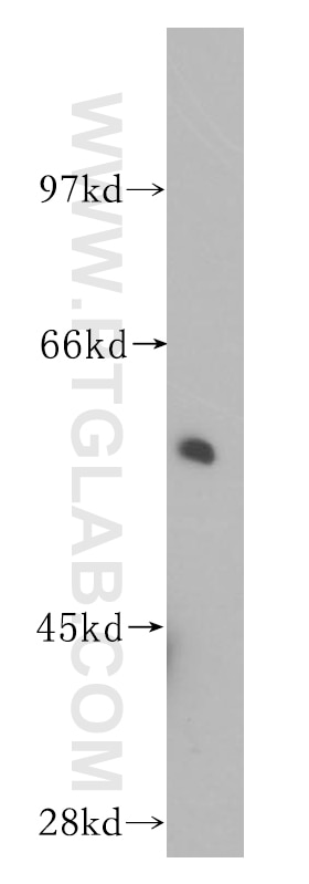 Western Blot (WB) analysis of human brain tissue using Sestrin 2 Polyclonal antibody (10795-1-AP)