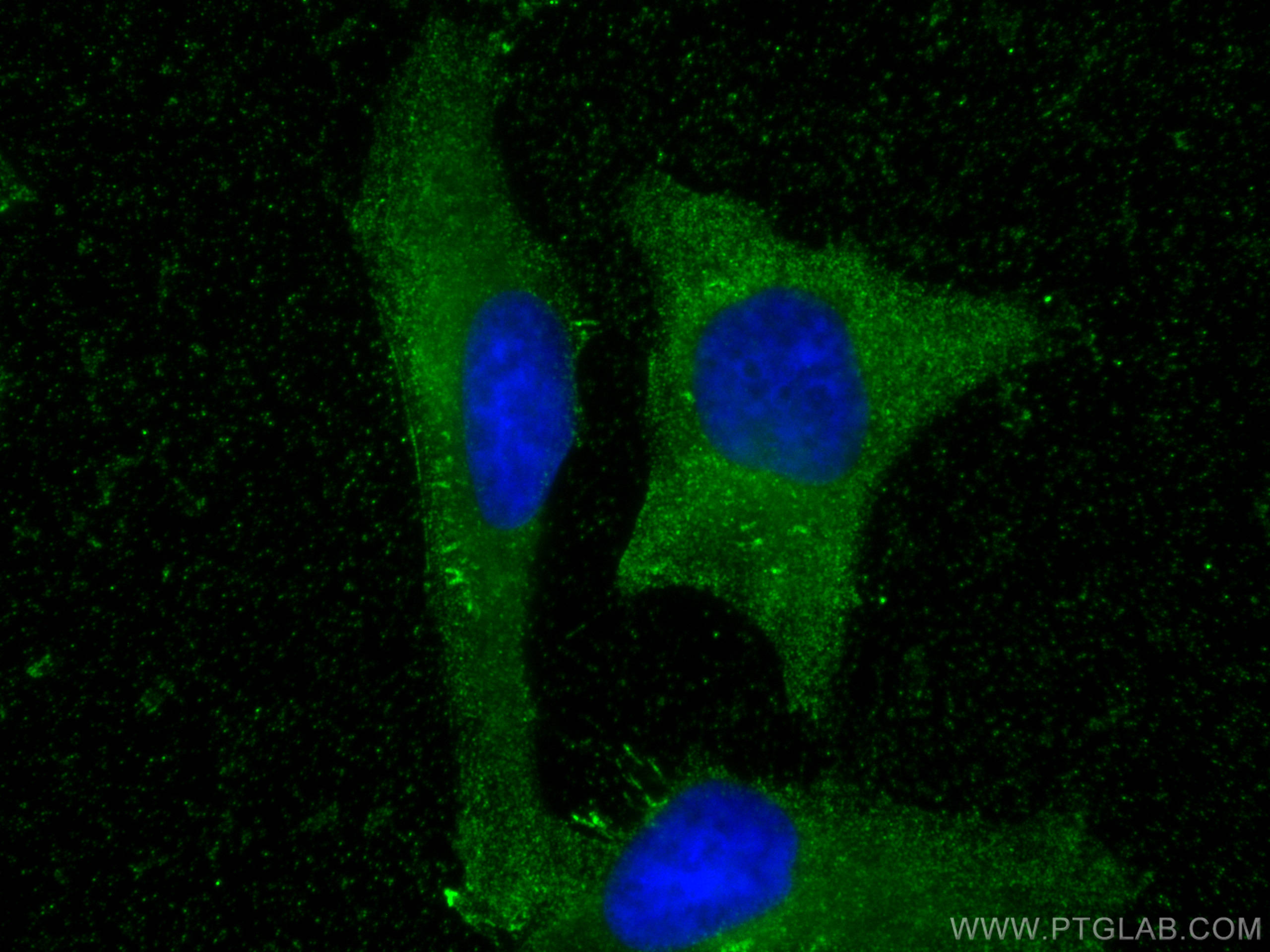 Immunofluorescence (IF) / fluorescent staining of HeLa cells using Sestrin 2 Monoclonal antibody (66297-1-Ig)