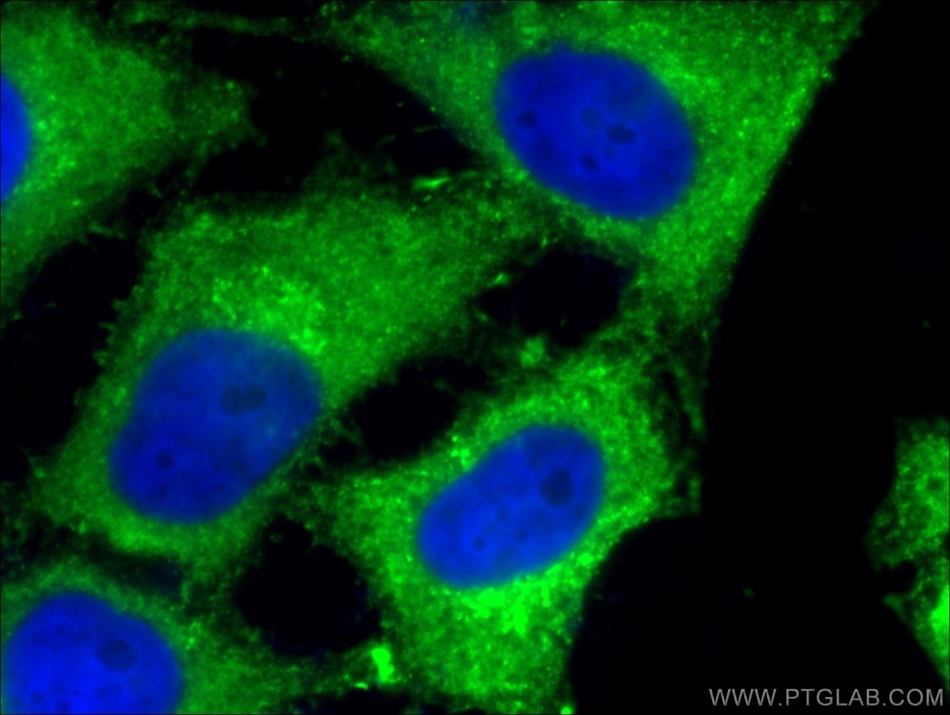 Immunofluorescence (IF) / fluorescent staining of HeLa cells using Sestrin 2 Monoclonal antibody (66297-1-Ig)
