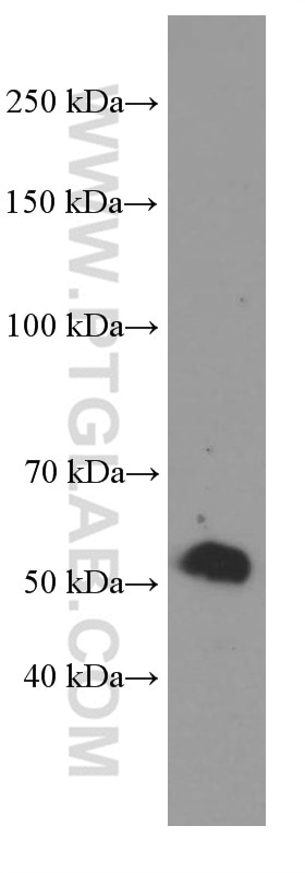 Western Blot (WB) analysis of pig liver tissue using Sestrin 2 Monoclonal antibody (66297-1-Ig)
