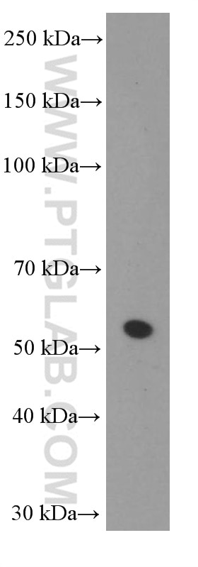 WB analysis of L02 using 66297-1-Ig