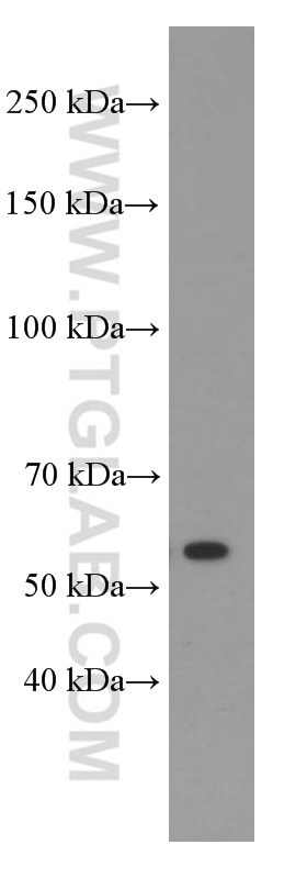Western Blot (WB) analysis of HeLa cells using Sestrin 2 Monoclonal antibody (66297-1-Ig)