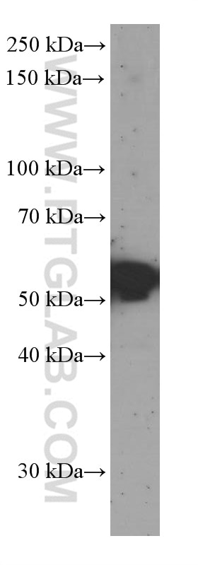 Western Blot (WB) analysis of HEK-293 cells using Sestrin 2 Monoclonal antibody (66297-1-Ig)