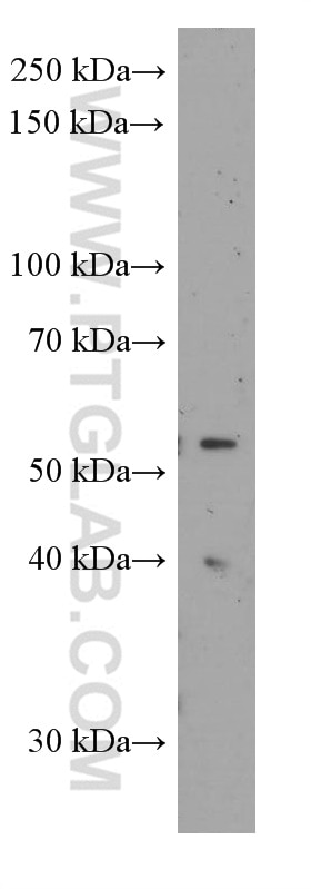 Western Blot (WB) analysis of ROS1728 cells using Sestrin 2 Monoclonal antibody (66297-1-Ig)