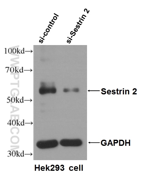 Western Blot (WB) analysis of HEK-293T cells using Sestrin 2 Monoclonal antibody (66297-1-Ig)