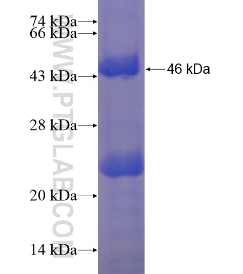 Sestrin2 fusion protein Ag20638 SDS-PAGE