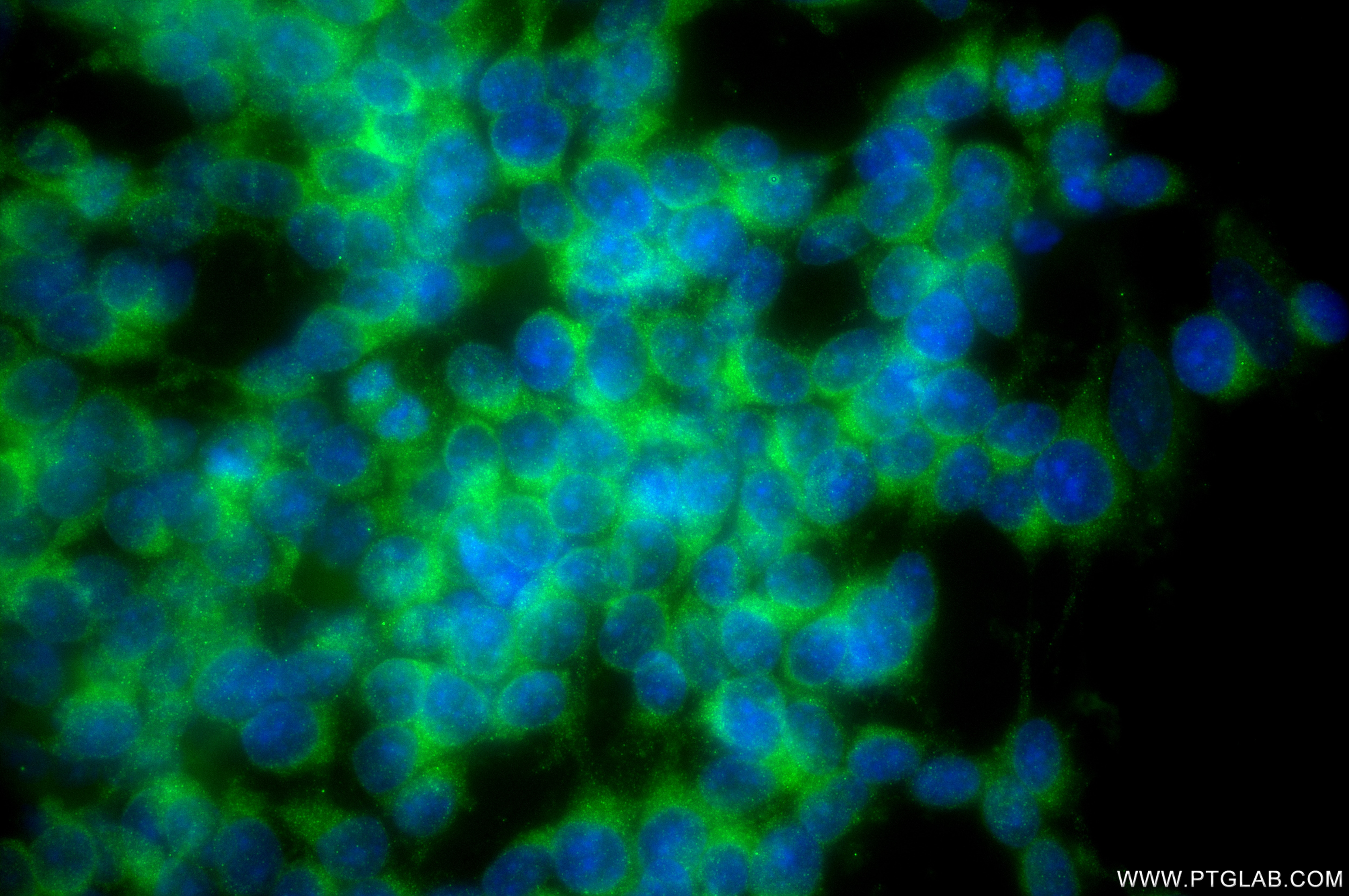 IF Staining of SH-SY5Y using 86541-2-RR (same clone as 86541-2-PBS) Immunofluorescence (IF) / fluorescent staining of SH-SY5Y cells using Shootin 1 Recombinant monoclonal antibody (86541-2-RR)