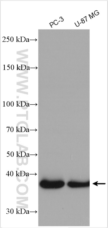 Western Blot (WB) analysis of various lysates using Siglec-15 Polyclonal antibody (28594-1-AP)