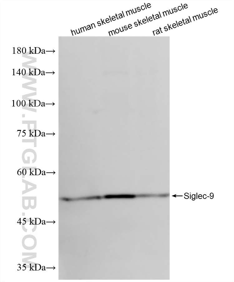 Western Blot (WB) analysis of various lysates using Siglec-9 Recombinant monoclonal antibody (84683-4-RR)