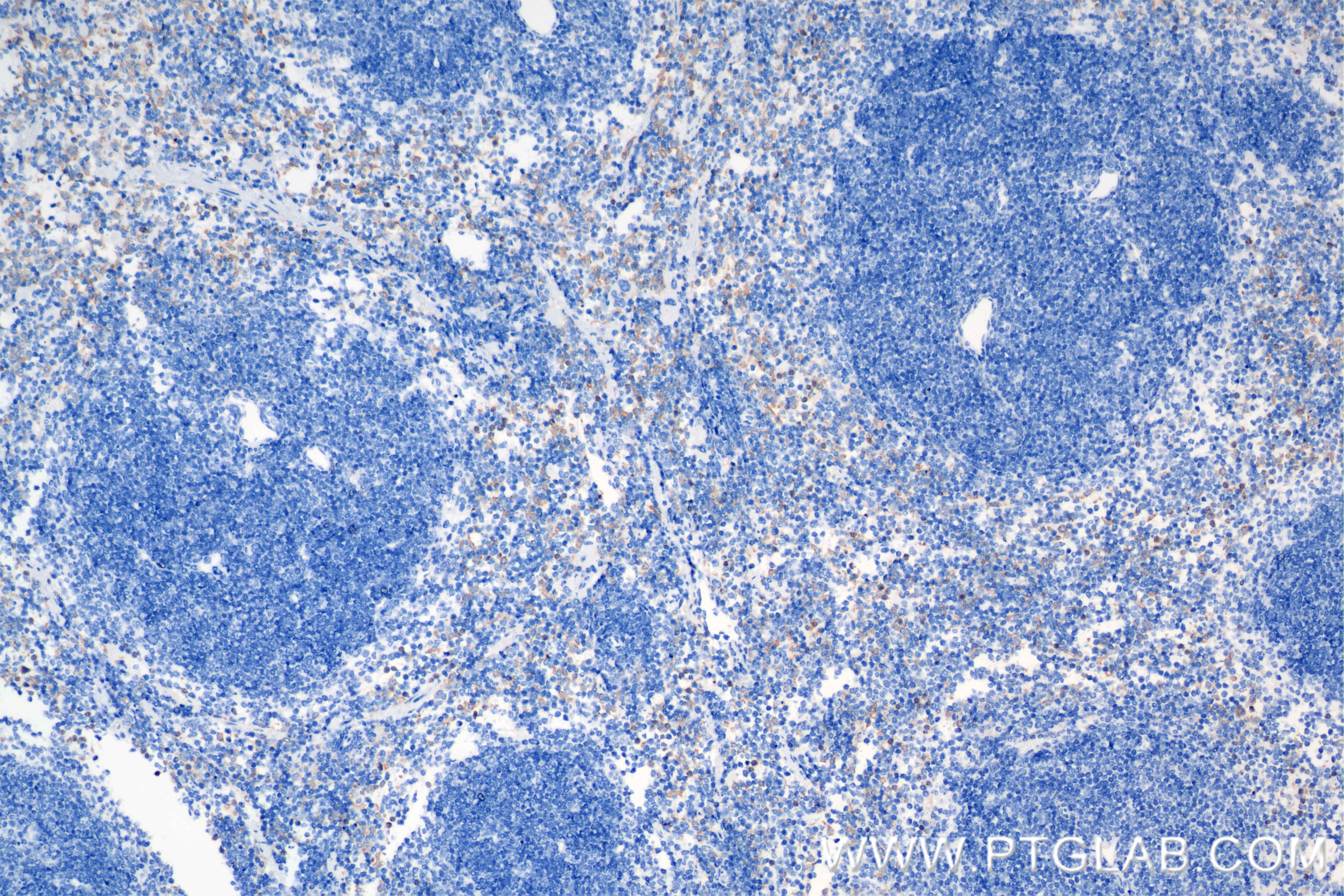 Immunohistochemistry (IHC) staining of mouse spleen tissue using Siglec-E Recombinant antibody (84790-2-RR)