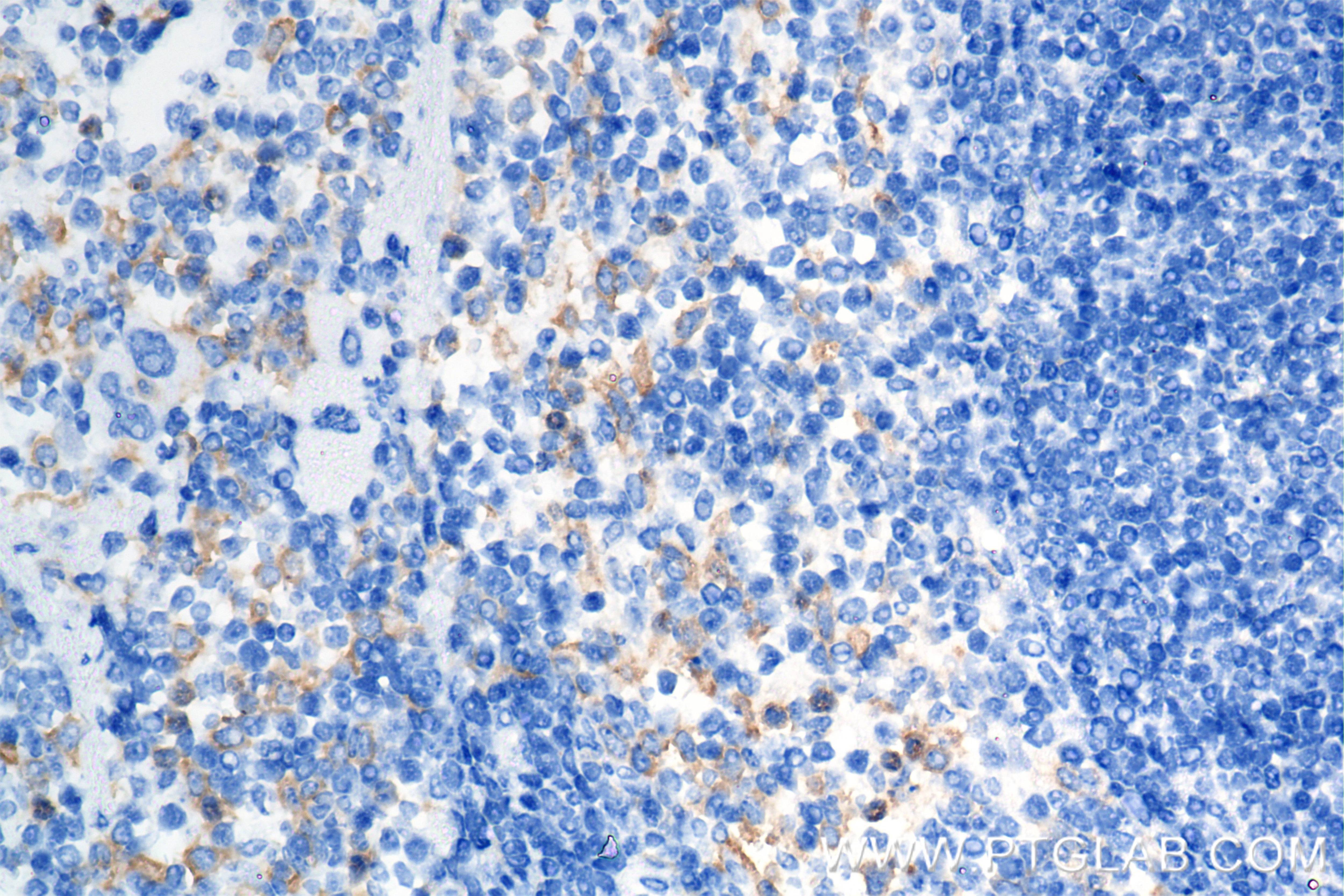 Immunohistochemistry (IHC) staining of mouse spleen tissue using Siglec-E Recombinant antibody (84790-2-RR)