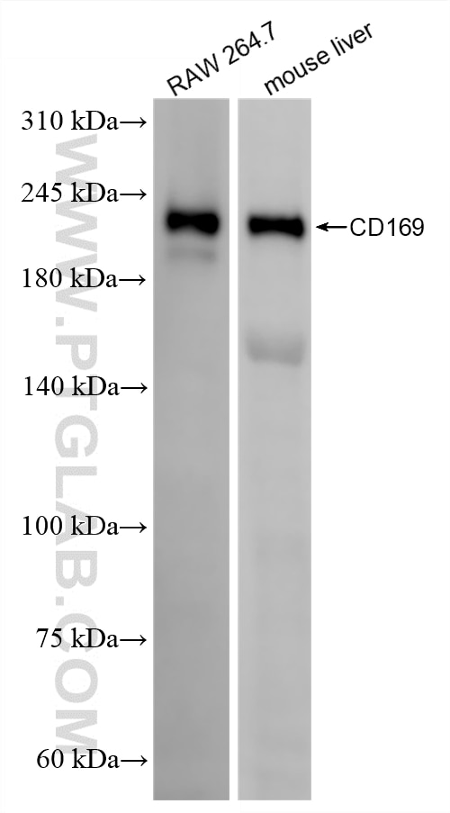 Western Blot (WB) analysis of various lysates using Siglec1 Recombinant monoclonal antibody (86605-1-RR)