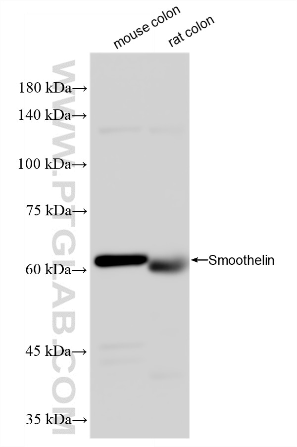 Western Blot (WB) analysis of various lysates using Smoothelin Recombinant monoclonal antibody (87674-7-RR)