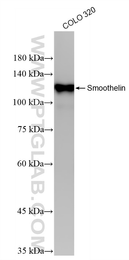 Western Blot (WB) analysis of COLO 320 cells using Smoothelin Recombinant monoclonal antibody (87674-7-RR)