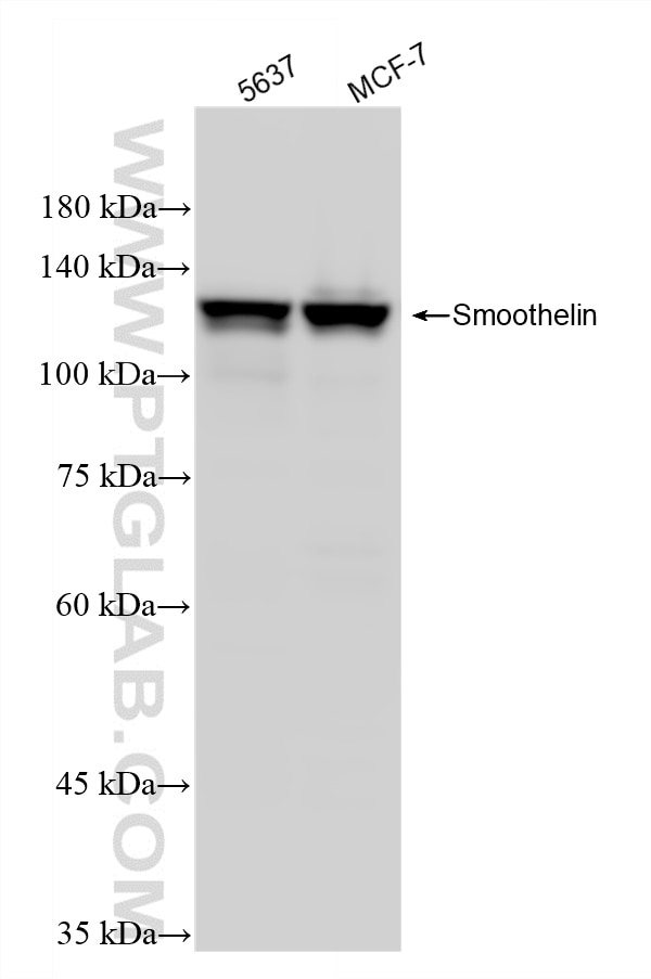 Western Blot (WB) analysis of various lysates using Smoothelin Recombinant monoclonal antibody (87674-7-RR)
