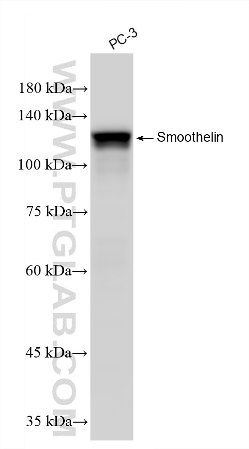 Western Blot (WB) analysis of various lysates using Smoothelin Recombinant monoclonal antibody (87674-7-RR)