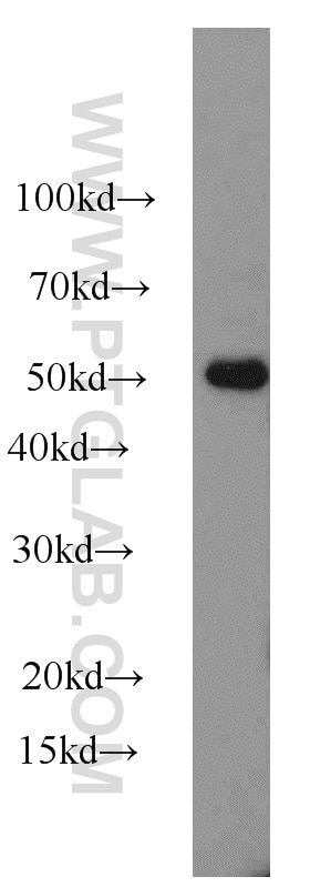 Western Blot (WB) analysis of mouse bladder tissue using Phospho-Smtnl1 (Ser301) Polyclonal antibody (19560-1-AP)