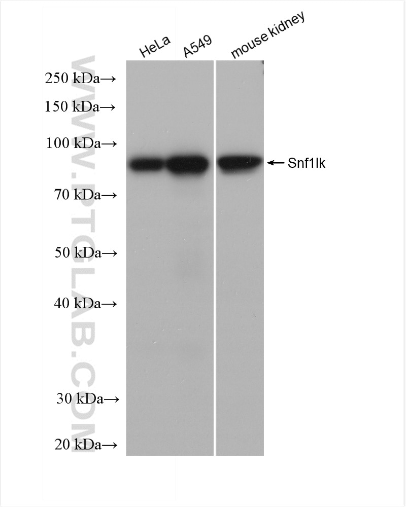 Western Blot (WB) analysis of various lysates using Snf1lk Recombinant antibody (82851-3-RR)