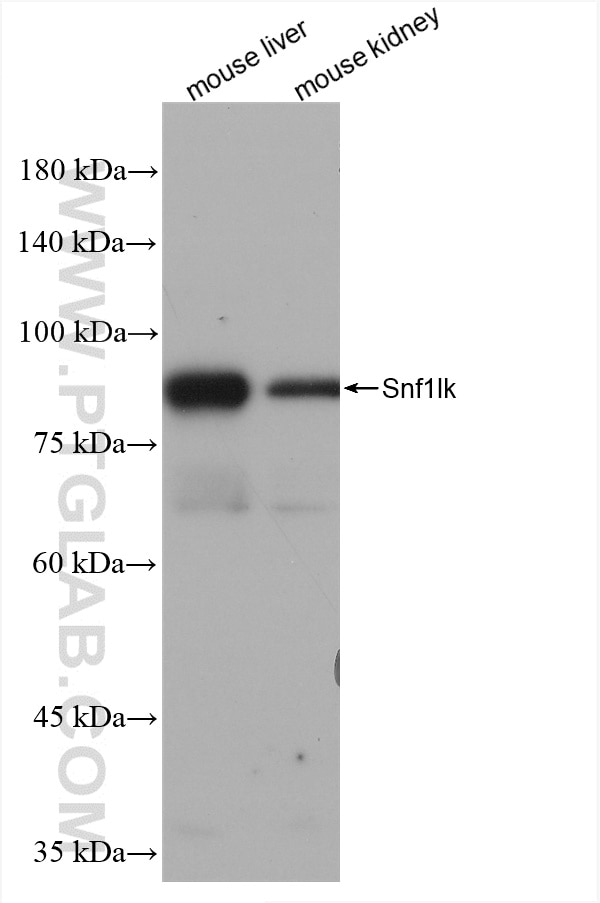 Western Blot (WB) analysis of various lysates using mouse Snf1lk Recombinant antibody (82851-4-RR)