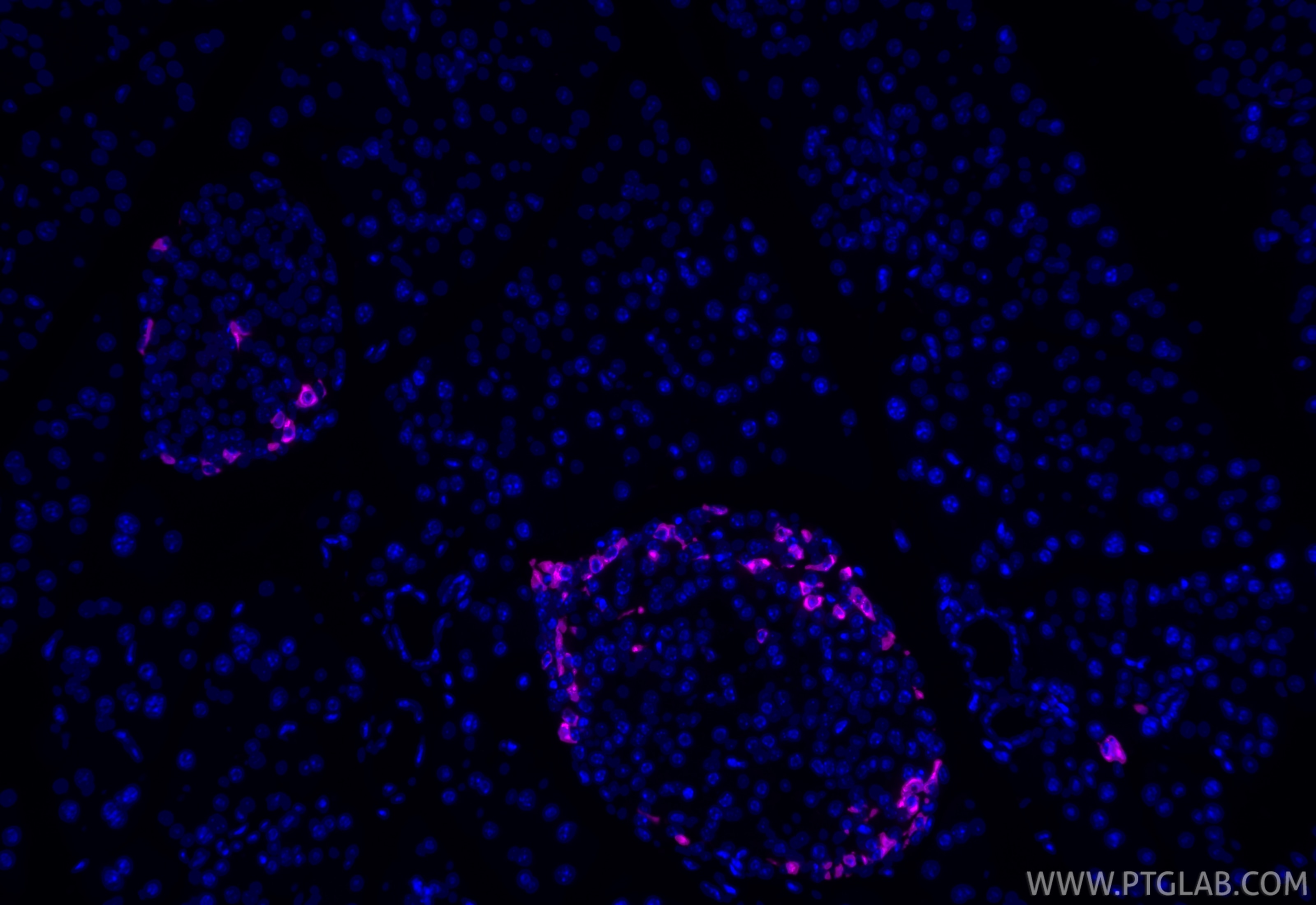 IF Staining of mouse pancreas using CL647-84351 Immunofluorescence (IF) / fluorescent staining of mouse pancreas tissue using CoraLite® Plus 647-conjugated Somatostatin Recombi (CL647-84351)