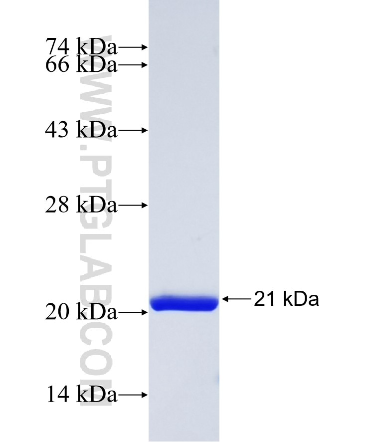 Sortase fusion protein Ag37061 SDS-PAGE