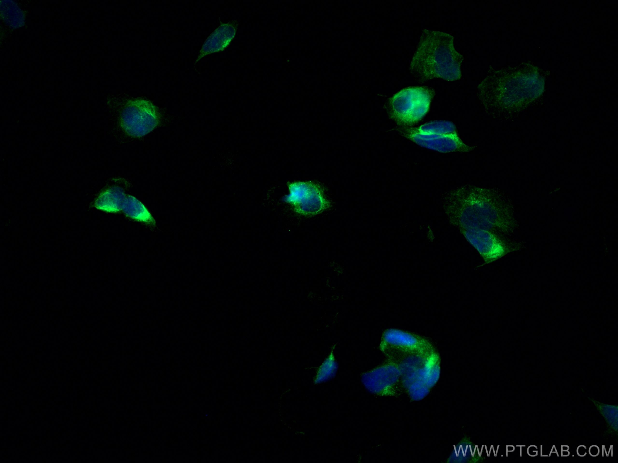 Immunofluorescence (IF) / fluorescent staining of SH-SY5Y cells using Sortilin Monoclonal antibody (68007-1-Ig)