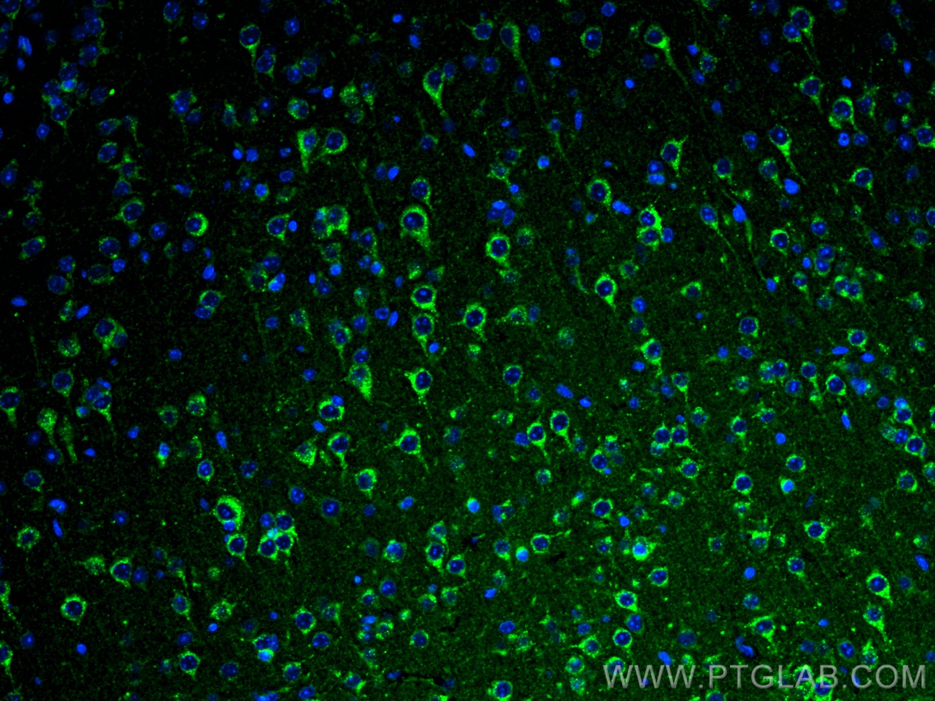 Immunofluorescence (IF) / fluorescent staining of mouse brain tissue using Sortilin Monoclonal antibody (68007-1-Ig)