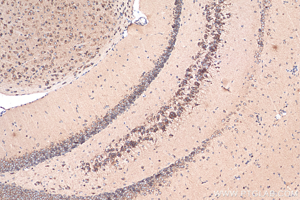 Immunohistochemistry (IHC) staining of mouse brain tissue using Sortilin Monoclonal antibody (68007-1-Ig)