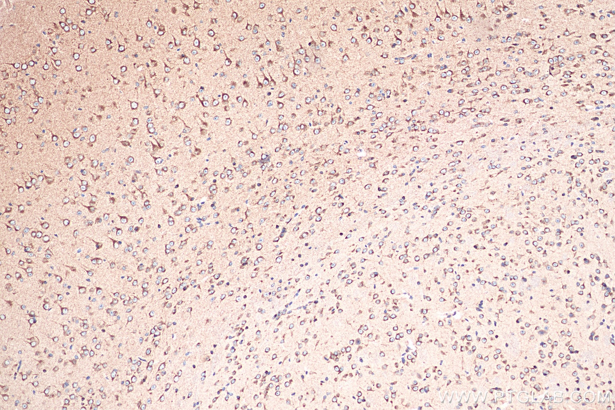 Immunohistochemistry (IHC) staining of mouse brain tissue using Sortilin Monoclonal antibody (68007-1-Ig)