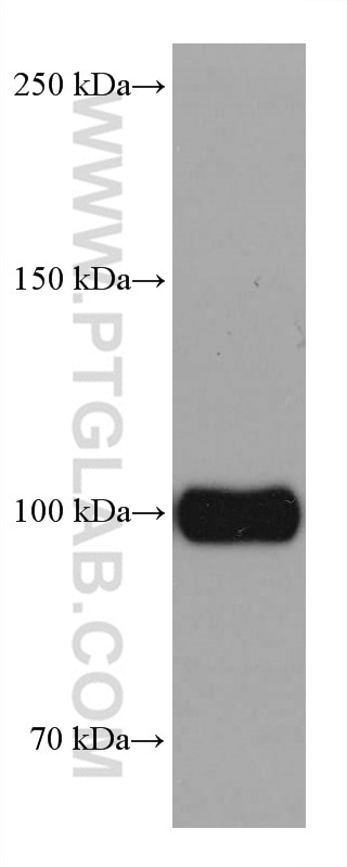 Western Blot (WB) analysis of mouse brain tissue using Sortilin Monoclonal antibody (68007-1-Ig)