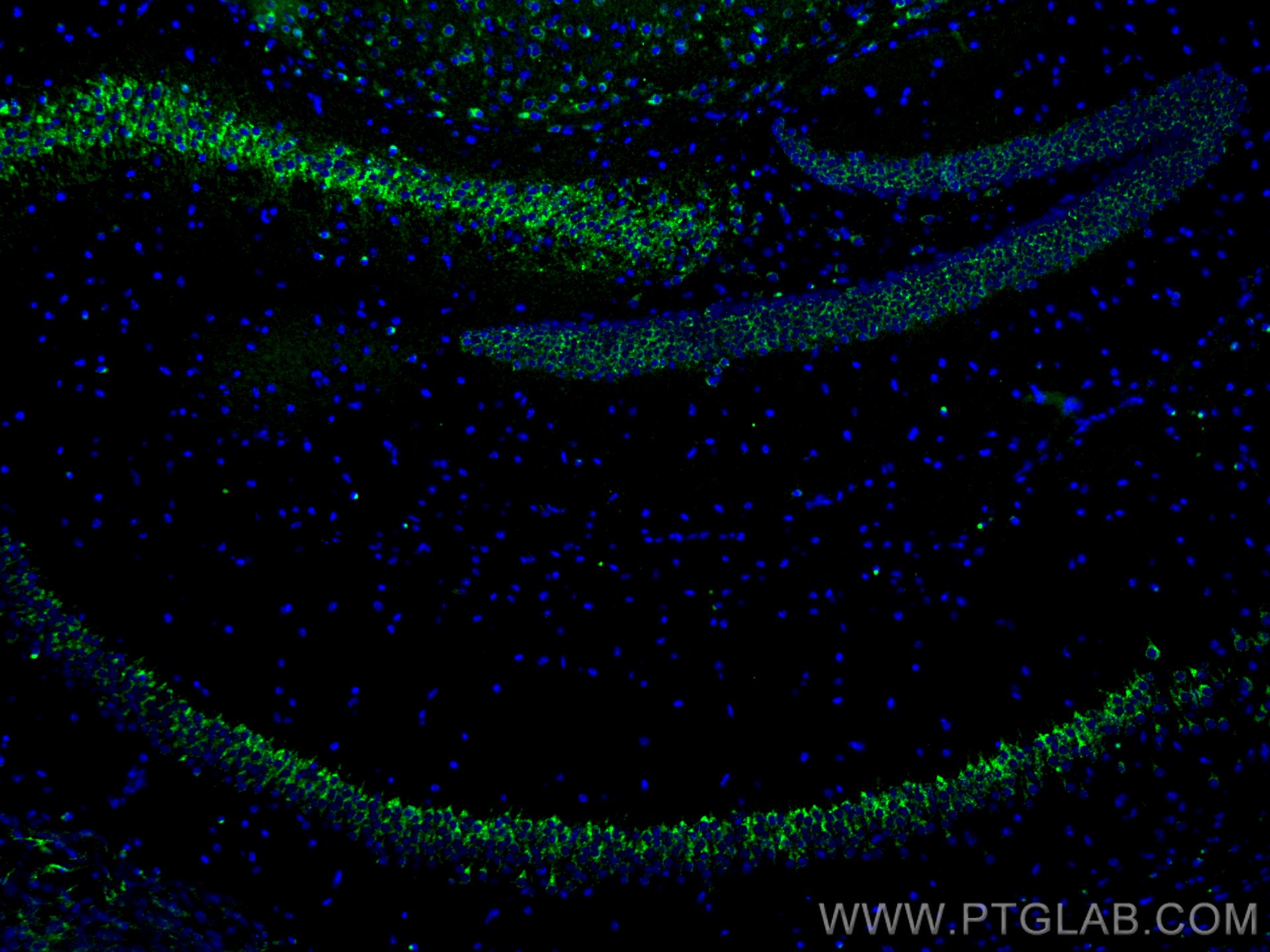 Immunofluorescence (IF) / fluorescent staining of mouse brain tissue using CoraLite® Plus 488-conjugated Sortilin Polyclonal  (CL488-12369)