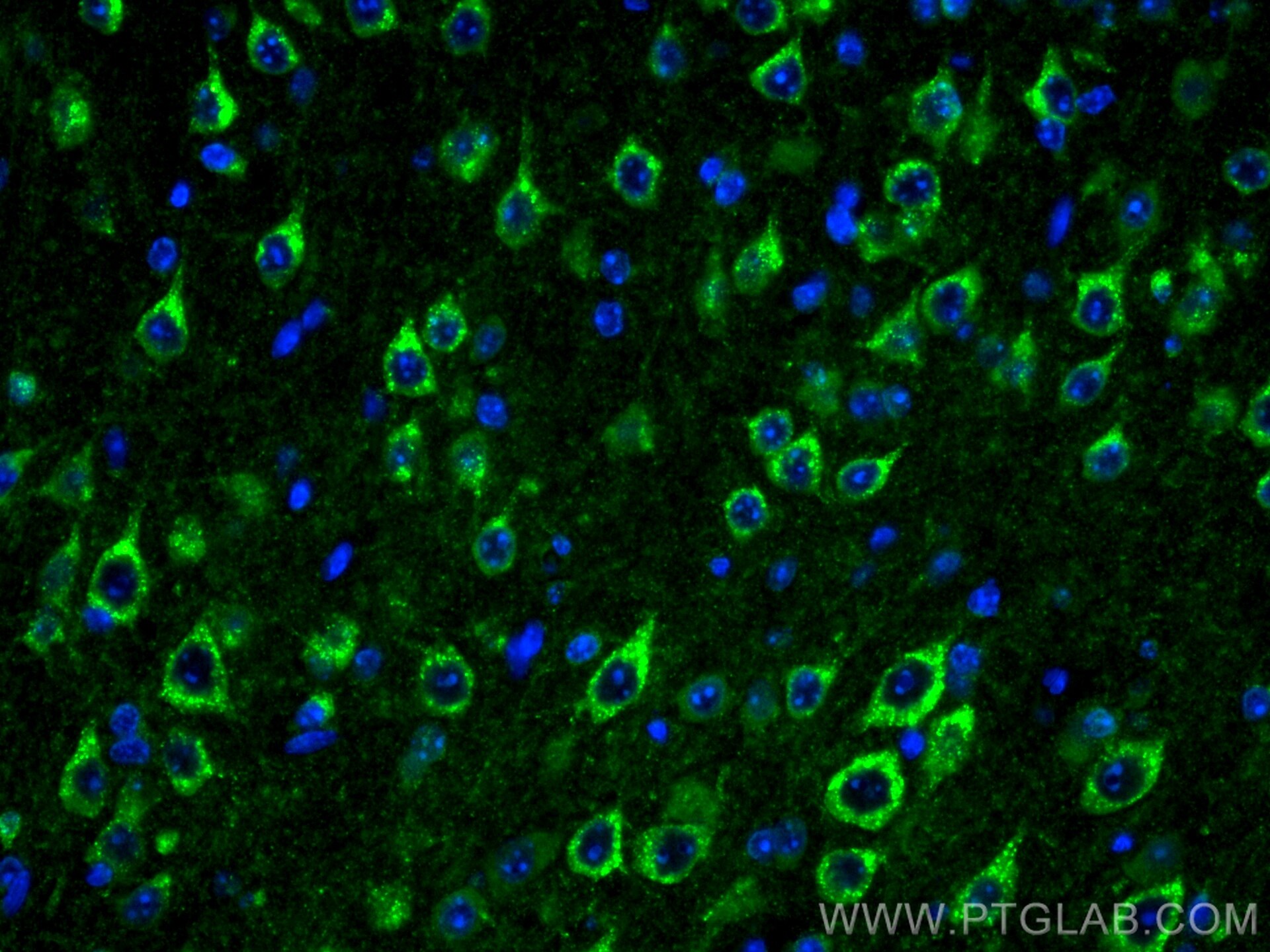 Immunofluorescence (IF) / fluorescent staining of mouse brain tissue using CoraLite® Plus 488-conjugated Sortilin Monoclonal  (CL488-68007)