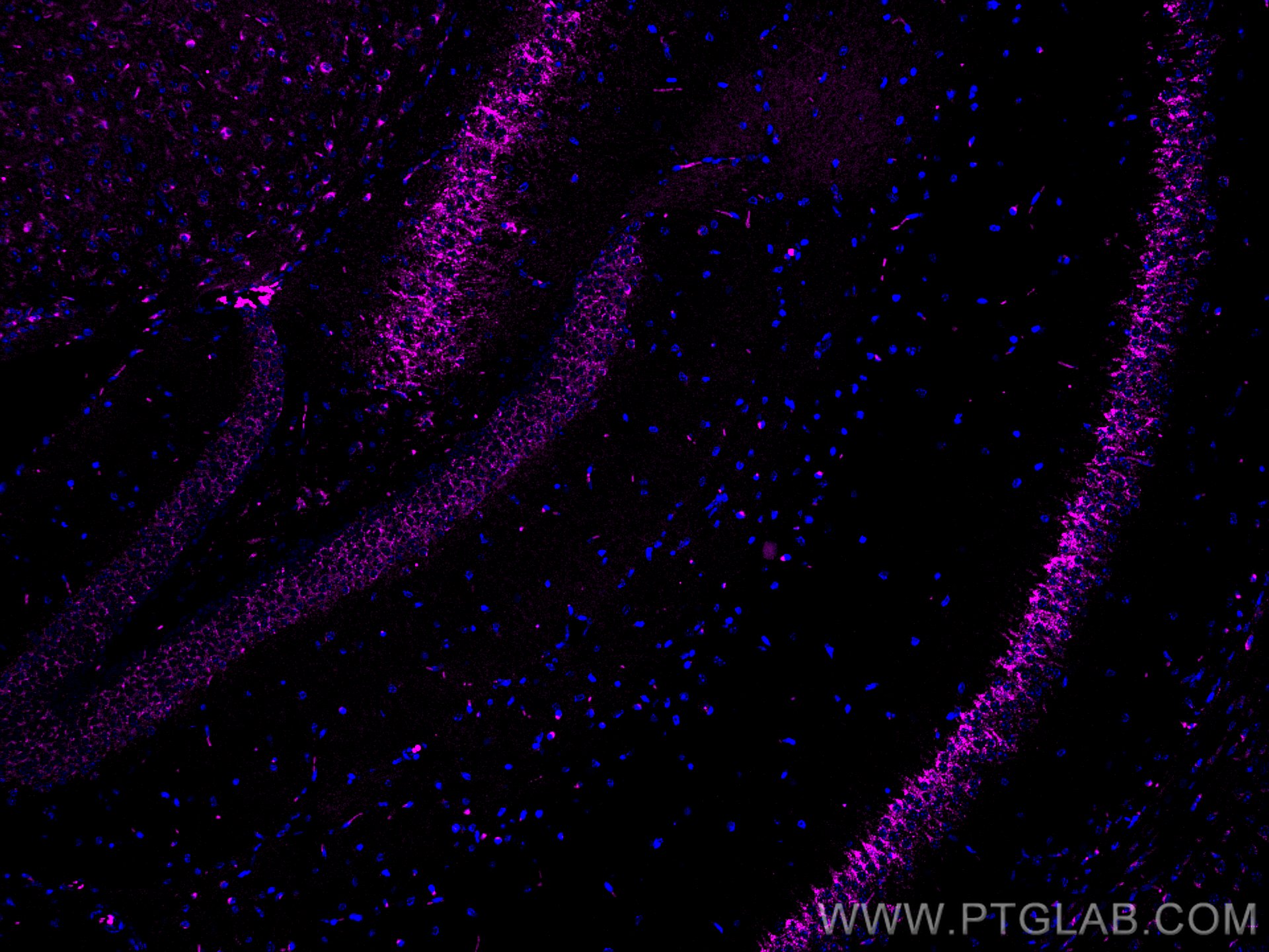 Immunofluorescence (IF) / fluorescent staining of mouse brain tissue using CoraLite® Plus 647-conjugated Sortilin Polyclonal  (CL647-12369)